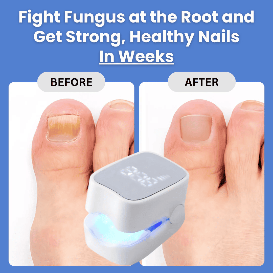 RTL™ Portable Light Therapy Device for Fungal Nail Repair