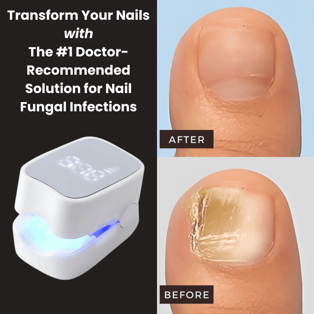RTL™ Portable Light Therapy Device for Fungal Nail Repair