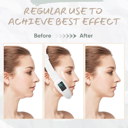 TechVixa™ Cteart V-Face Sculptor – EMS & LED Facial Lifting Belt